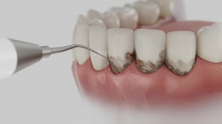 Trusted Teeth Cleaning And Checkup service in Jonesboro, IL - Dentist Open Now
